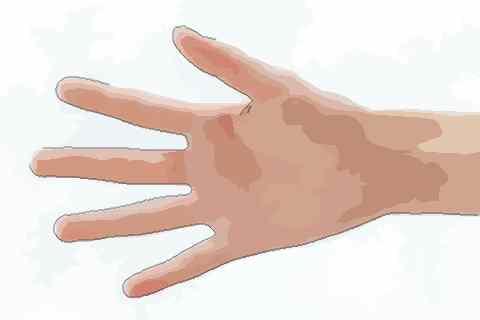 手指有痣代表着什么 手指长痣的含义解读