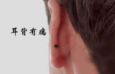 耳背有痣代表什么 男人耳朵背面有痣图解
